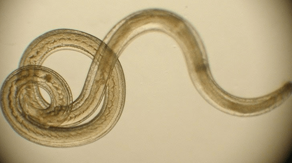 Wurmparasit aus dem menschlichen Körper