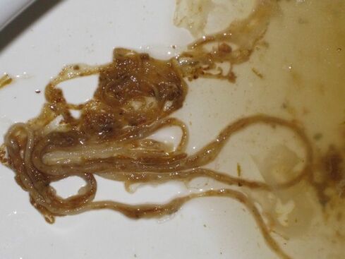 Würmer Parasiten aus dem menschlichen Körper