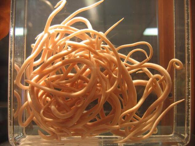 Spulwürmer sind Würmer, die zur Klasse der Nematoden gehören. 