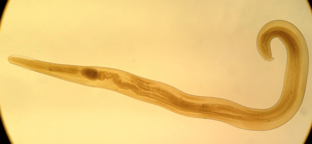 Madenwürmer sind ein häufiger Parasit bei Kindern. 